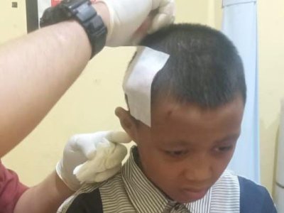 Nekat Lawan Buaya, Bocah 14 Tahun Selamatkan Rekannya dari Maut