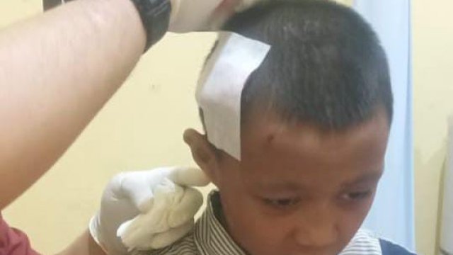 Nekat Lawan Buaya, Bocah 14 Tahun Selamatkan Rekannya dari Maut